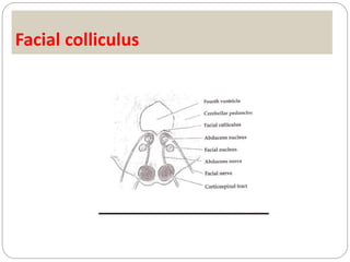 Facial colliculus
 