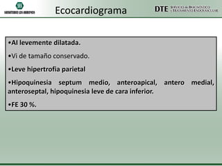Ecocardiograma
•AI levemente dilatada.

•Vi de tamaño conservado.
•Leve hipertrofia parietal
•Hipoquinesia septum medio, anteroapical, antero medial,
anteroseptal, hipoquinesia leve de cara inferior.
•FE 30 %.

 