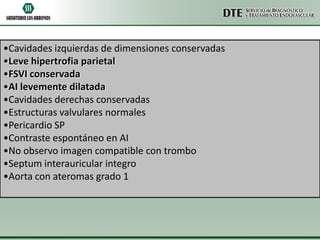•Cavidades izquierdas de dimensiones conservadas
•Leve hipertrofia parietal
•FSVI conservada
•AI levemente dilatada
•Cavidades derechas conservadas
•Estructuras valvulares normales
•Pericardio SP
•Contraste espontáneo en AI
•No observo imagen compatible con trombo
•Septum interauricular integro
•Aorta con ateromas grado 1

 