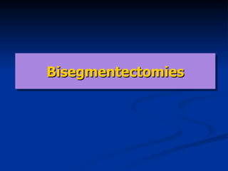 Bisegmentectomi es 