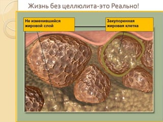 Жизнь без целлюлита-это Реально!

 
