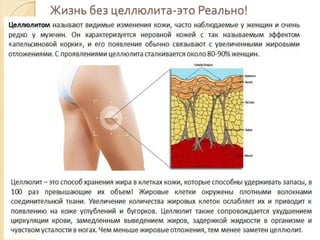 Жизнь без целлюлита-это Реально!

 