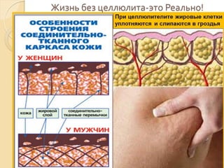 Жизнь без целлюлита-это Реально!

 