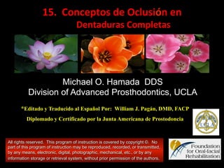 15.	
  	
  Conceptos	
  de	
  Oclusión	
  en	
  
	
  Dentaduras	
  Completas	
  

Michael O. Hamada DDS
Division of Advanced Prosthodontics, UCLA
*Editado y Traducido al Español Por: William J. Pagán, DMD, FACP
Diplomado y Certificado por la Junta Americana de Prostodoncia

All rights reserved. This program of instruction is covered by copyright ©. No
part of this program of instruction may be reproduced, recorded, or transmitted,
by any means, electronic, digital, photographic, mechanical, etc., or by any
information storage or retrieval system, without prior permission of the authors.

 