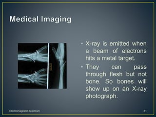 • X-ray is emitted when
a beam of electrons
hits a metal target.
• They can pass
through flesh but not
bone. So bones will
show up on an X-ray
photograph.
Electromagnetic Spectrum 31
 