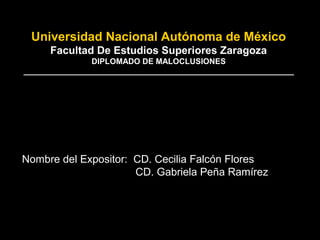 Universidad Nacional Autónoma de México
Facultad De Estudios Superiores Zaragoza
DIPLOMADO DE MALOCLUSIONES
_____________________________________________________________
Nombre del Expositor: CD. Cecilia Falcón Flores
CD. Gabriela Peña Ramírez
 