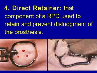 Retainer In Rpd 15. introduction to removable partial dentures | PPT
