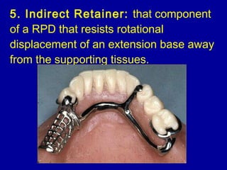 Retainer In Rpd 15. introduction to removable partial dentures | PPT