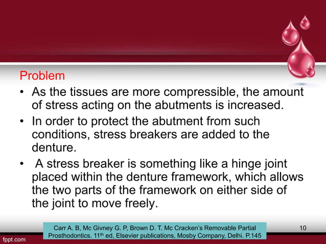 stress-breakers-in-prosthodontics-ppt