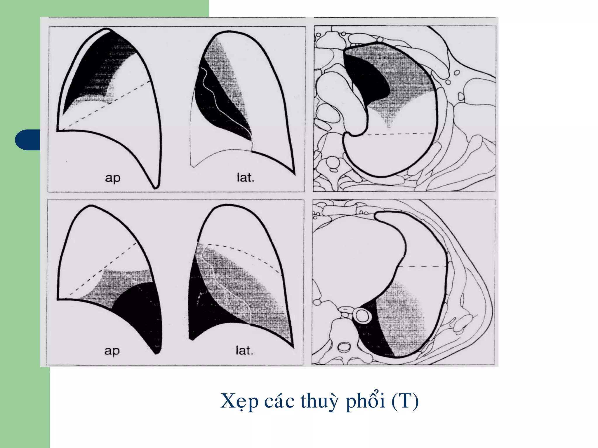 Xeïp caùc thuyø phoåi (T)
 