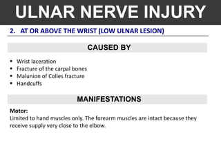 2. AT OR ABOVE THE WRIST (LOW ULNAR LESION)
ULNAR NERVE INJURY
 Wrist laceration
 Fracture of the carpal bones
 Malunion of Colles fracture
 Handcuffs
Motor:
Limited to hand muscles only. The forearm muscles are intact because they
receive supply very close to the elbow.
CAUSED BY
MANIFESTATIONS
 