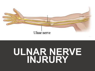 ULNAR NERVE
INJRURY
 