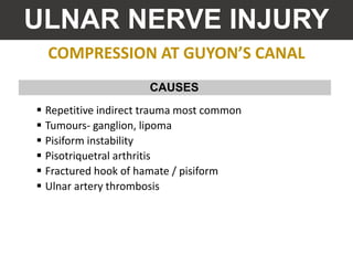 COMPRESSION AT GUYON’S CANAL
ULNAR NERVE INJURY
 Repetitive indirect trauma most common
 Tumours- ganglion, lipoma
 Pisiform instability
 Pisotriquetral arthritis
 Fractured hook of hamate / pisiform
 Ulnar artery thrombosis
CAUSES
 