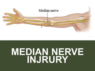 MEDIAN NERVE
INJRURY
 