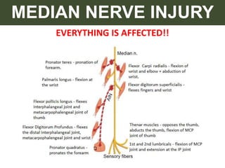 EVERYTHING IS AFFECTED!!
MEDIAN NERVE INJURY
 