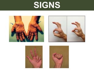 SIGNS
 