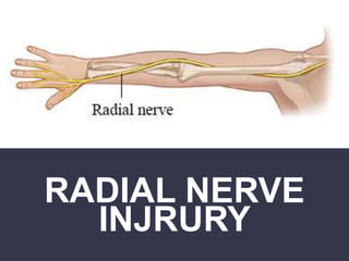 RADIAL NERVE
INJRURY
 