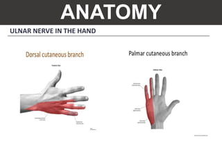 ANATOMY
ULNAR NERVE IN THE HAND
 