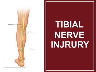 TIBIAL
NERVE
INJRURY
 