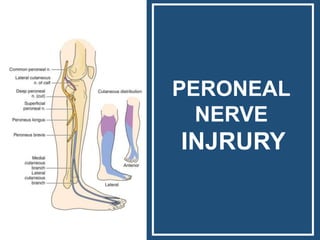 PERONEAL
NERVE
INJRURY
 