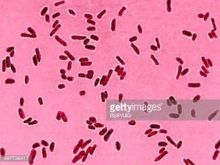 15. shigella