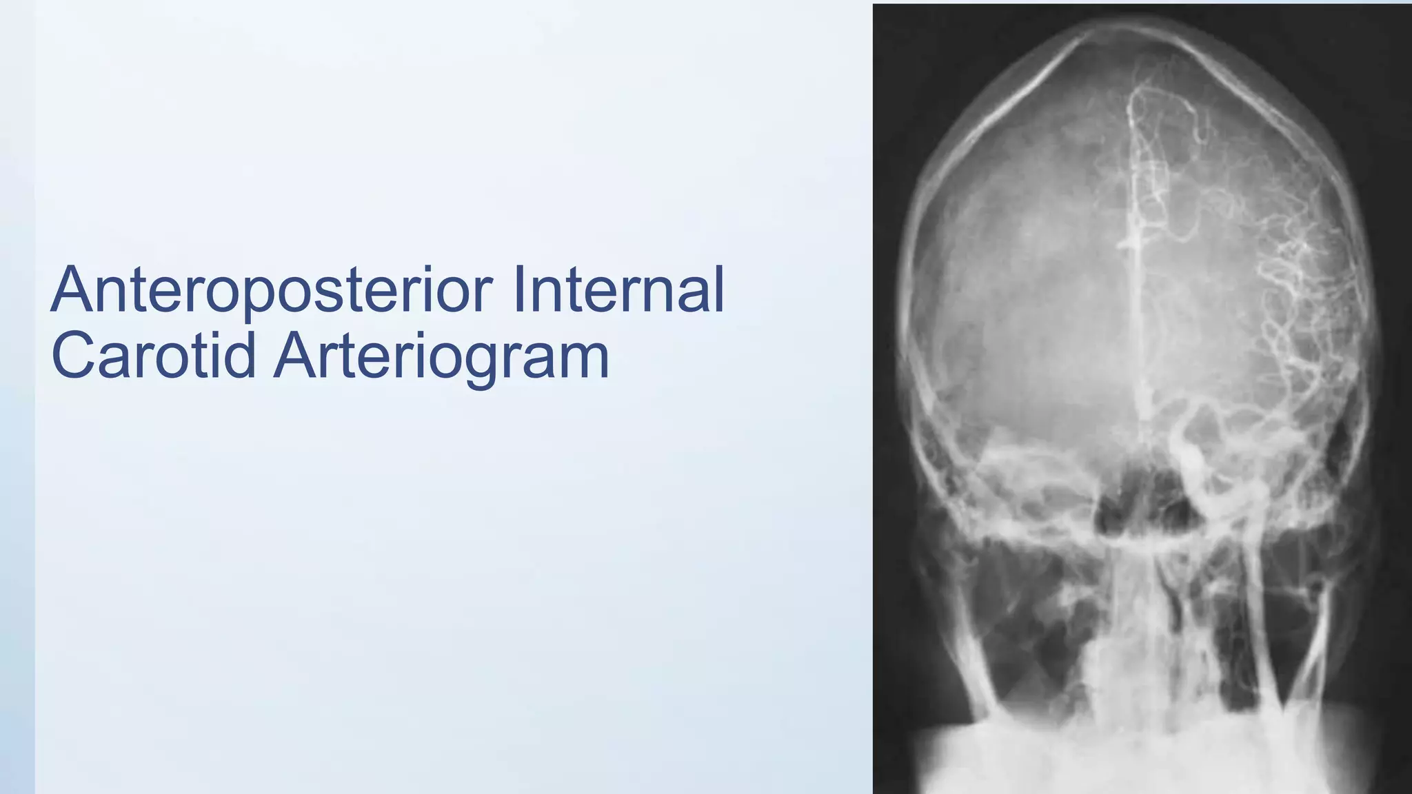 Radiographic Anatomy of the Head and Neck | PPTX
