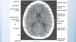 Radiographic Anatomy of the Head and Neck | PPTX