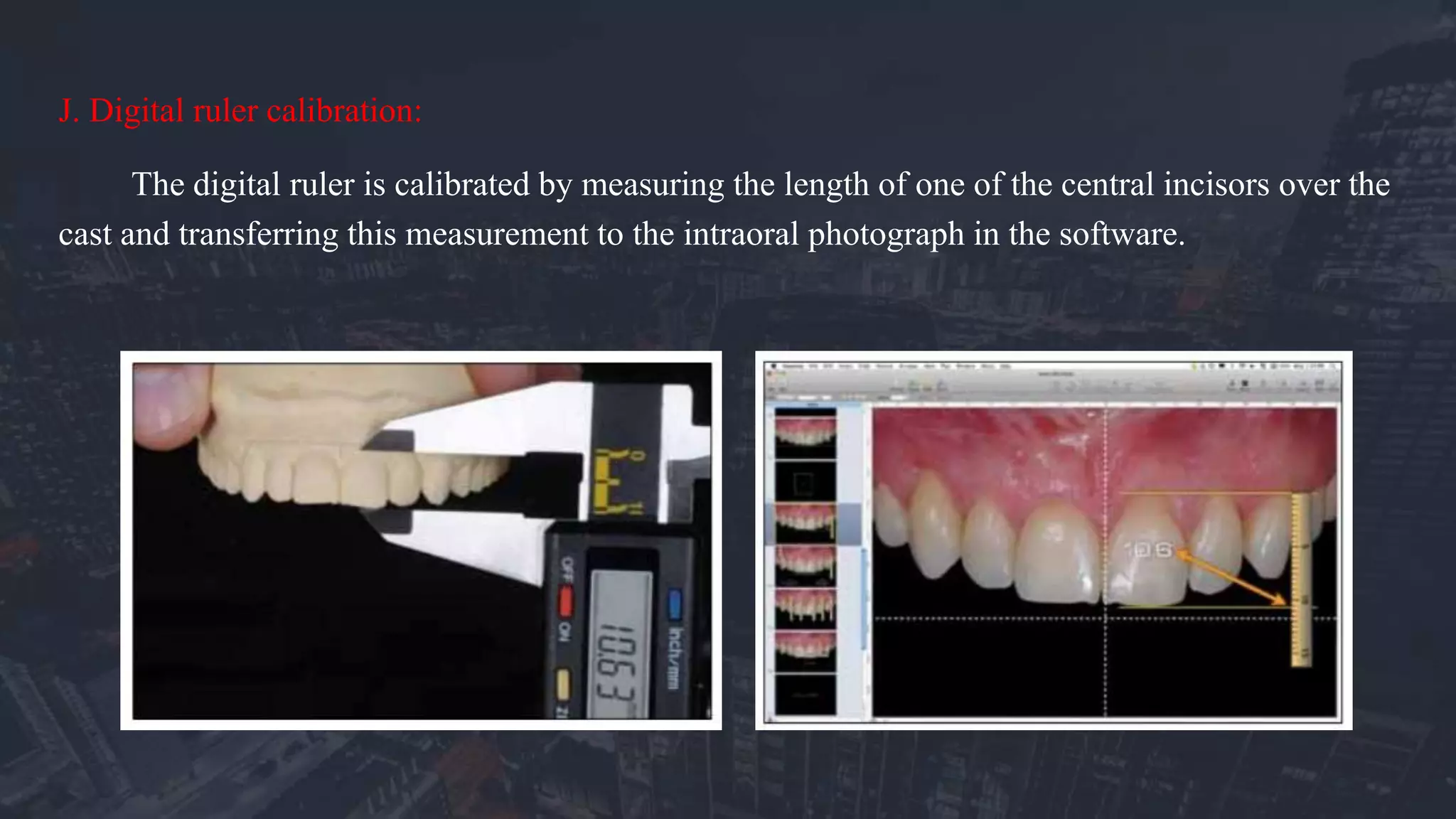Digital Smile Designing | PPTX