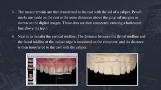 3. The measurements are then transferred to the cast with the aid of a caliper. Pencil
marks are made on the cast at the same distances above the gingival margins as
shown on the digital images. Those dots are then connected, creating a horizontal
line above the teeth.
4. Next is to transfer the vertical midline. The distance between the dental midline and
the facial midline at the incisal edge is measured on the computer, and the distance
is then transferred to the cast with the caliper.
 