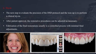 L. Try-in
• The next step to evaluate the precision of the DSD protocol and the wax-up is to perform
a clinical try-in.
• After patient approval, the restorative procedures can be adjusted as necessary.
• Fabrication of the final restorations usually is a controlled process with minimal final
adjustments.
 