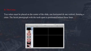 B. The Cross:
Two rulers must be placed on the center of the slide, one horizontal & one vertical, forming a
cross. The facial photograph with the teeth apart is positioned behind these lines.
 