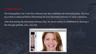C. Digital facebow:
The interpupillary line is the first reference line that establishes the horizontal plane. The face
as a whole is analyzed before determining the best horizontal reference to achieve harmony.
After determining the horizontal reference line, the facial midline is established by drawing a
line through glabella, nose, and chin.
 