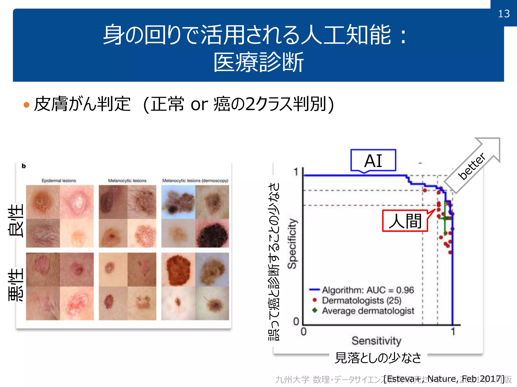 13
13
身の回りで活用される人工知能：
医療診断
 皮膚がん判定 (正常 or 癌の2クラス判別)
九州大学 数理・データサイエンス教育研究センター／ 2021年7月版
見落としの少なさ
誤って癌と診断することの少なさ
[Esteva+, Nature, Feb 2017]
AI
人間
良性
悪性
 
