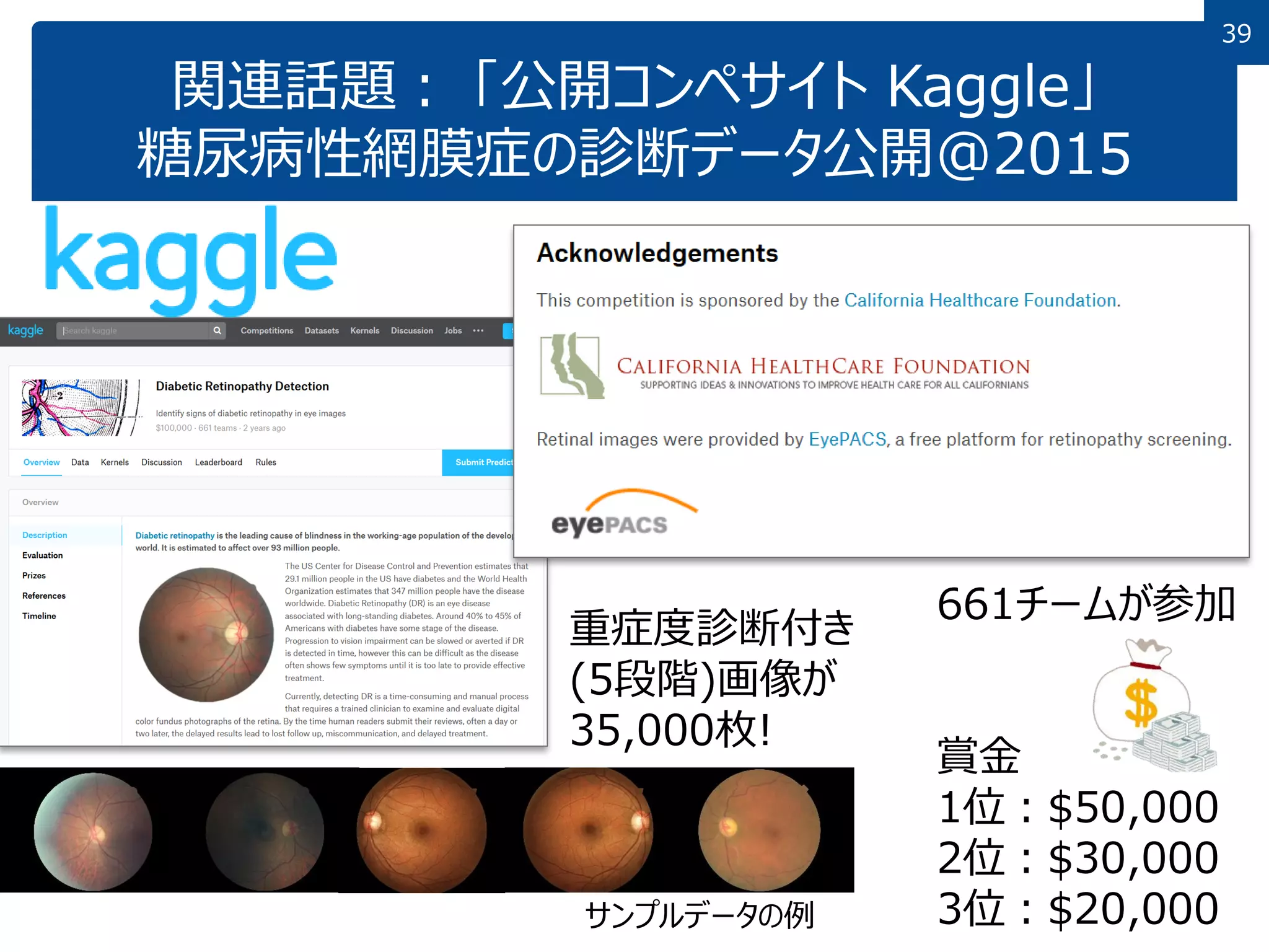 39
関連話題： 「公開コンペサイト Kaggle」
糖尿病性網膜症の診断データ公開@2015
661チームが参加
賞金
1位：$50,000
2位：$30,000
3位：$20,000
サンプルデータの例
重症度診断付き
(5段階)画像が
35,000枚!
 