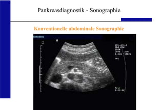 UKA Medizinische Klinik III RWTH Aachen
Pankreasdiagnostik - Sonographie
Konventionelle abdominale Sonographie
 