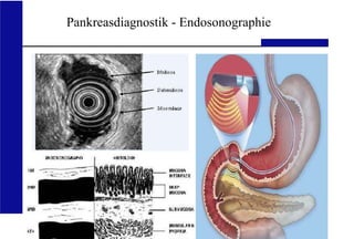 UKA Medizinische Klinik III RWTH Aachen
Pankreasdiagnostik - Endosonographie
 