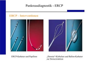 UKA Medizinische Klinik III RWTH Aachen
Pankreasdiagnostik - ERCP
ERCP – Interventionen
ERCP-Katheter und Papillom „Dormia“-Körbchen und Ballon-Katheter
zur Steinextraktion
 