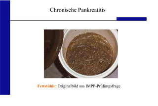 UKA Medizinische Klinik III RWTH Aachen
Chronische Pankreatitis
Fettstühle: Originalbild aus IMPP-Prüfungsfrage
 