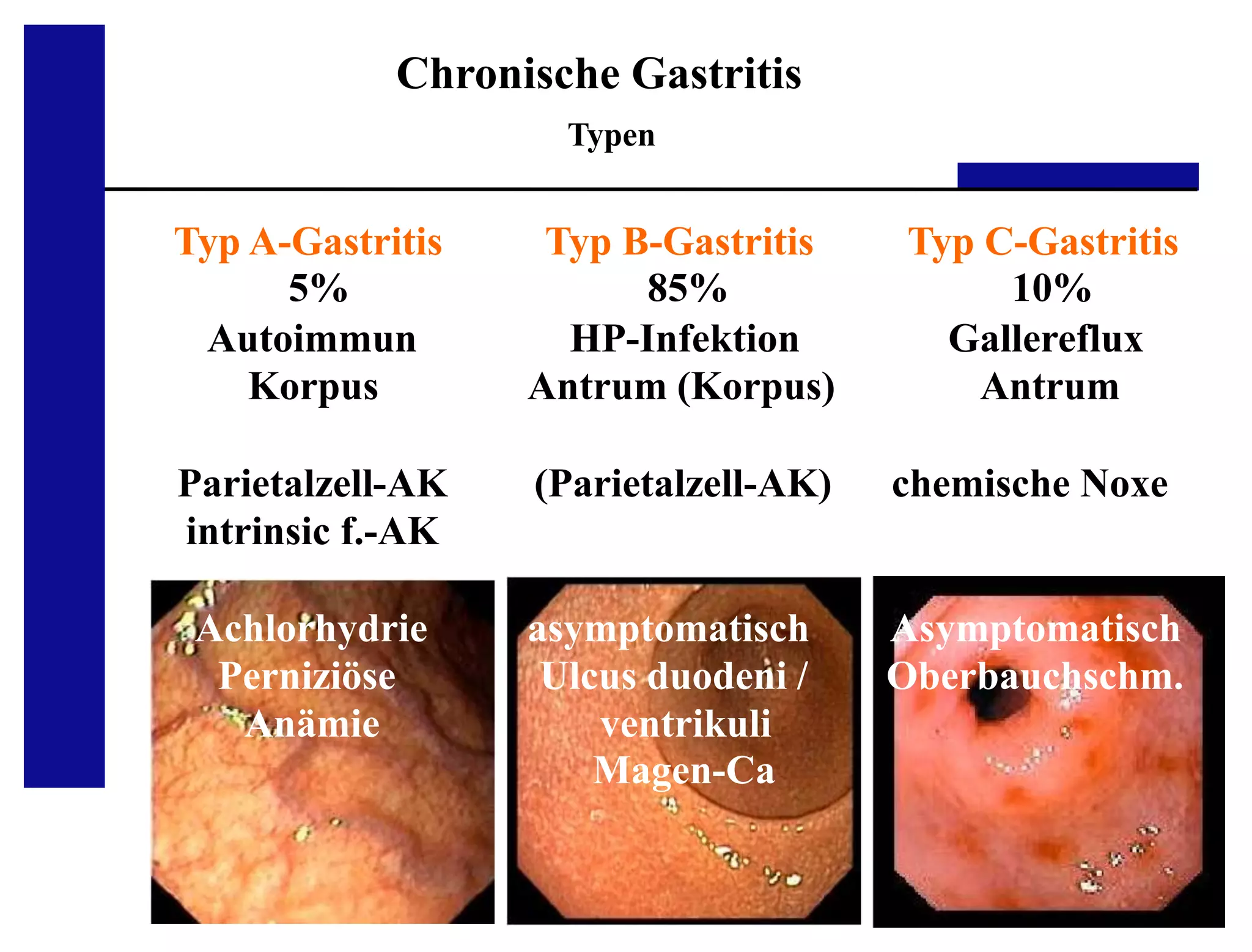 Galle Reflux Gastritis Typ C www.slideshare.net