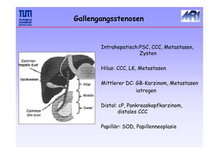 Gallengangsstenosen
Intrahepatisch:PSC, CCC, Metastasen,
Zysten
Hilus: CCC, LK, Metastasen
Mittlerer DC: GB-Karzinom, Metastasen
iatrogen
Distal: cP, Pankreaskopfkarzinom,
distales CCC
Papillär: SOD, Papillenneoplasie
 