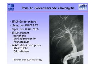 Prim är Sklerosierende Cholangitis
• ERCP Goldstandard
• Sens. der MRCP 82%
• Spez. der MRCP 98%
• ERCP erkennt
periphere
Veränderungen im
Frühstadium
• MRCP detektiert prae-
stenotische
Dilatationen
Talwalkar et al, 2004 Hepatology
 
