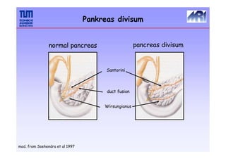 pancreas divisum
Santorini
duct fusion
Wirsungianus
normal pancreas
mod. from Soehendra et al 1997
Pankreas divisum
 