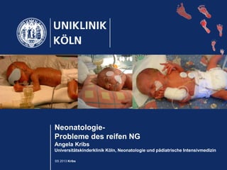 SS 2013 Kribs
Neonatologie-
Probleme des reifen NG
Angela Kribs
Universitätskinderklinik Köln, Neonatologie und pädiatrische Intensivmedizin
 