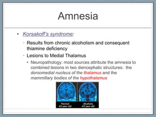 Amnesia
• Results from chronic alcoholism and consequent
thiamine deficiency
• Lesions to Medial Thalamus
• Neuropathology: most sources attribute the amnesia to
combined lesions in two diencephalic structures: the
dorsomedial nucleus of the thalamus and the
mammillary bodies of the hypothalamus
• Korsakoff’s syndrome:
 