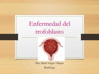Enfermedad del
trofoblasto
Dra. Maria Vargas Villagra
Radiologa
 