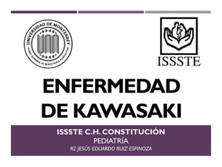 ENFERMEDAD
DE KAWASAKI
ISSSTE C.H. CONSTITUCIÓN
PEDIATRÍA
R2 JESÚS EDUARDO RUIZ ESPINOZA
 