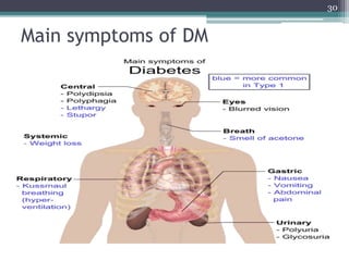 Main symptoms of DM
30
 