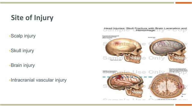 15. Head Trauma & Management (Primary Management Of Head Injury).ppt