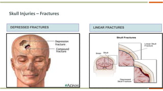 Skull Potential Injuries 15. Head Trauma & Management (Primary Management Of Head Injury).ppt
