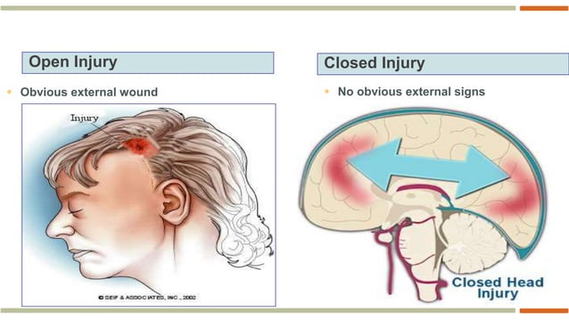 15. Head Trauma & Management (Primary Management Of Head Injury).ppt